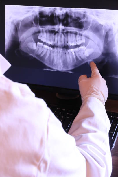Best Emergency Tooth Extraction in Thompsons Station, TN