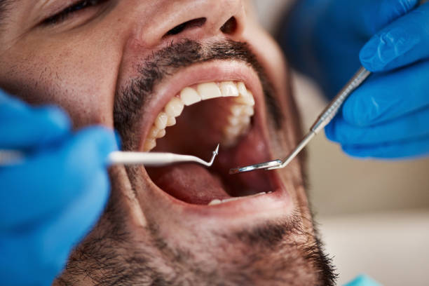 Best Emergency Tooth Extraction in Thompsons Station, TN